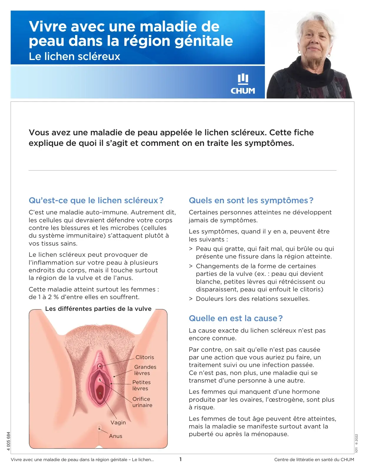 « Le lichen scléreux » : définition de la maladie, symptômes, causes et schéma anatomique de la vulve