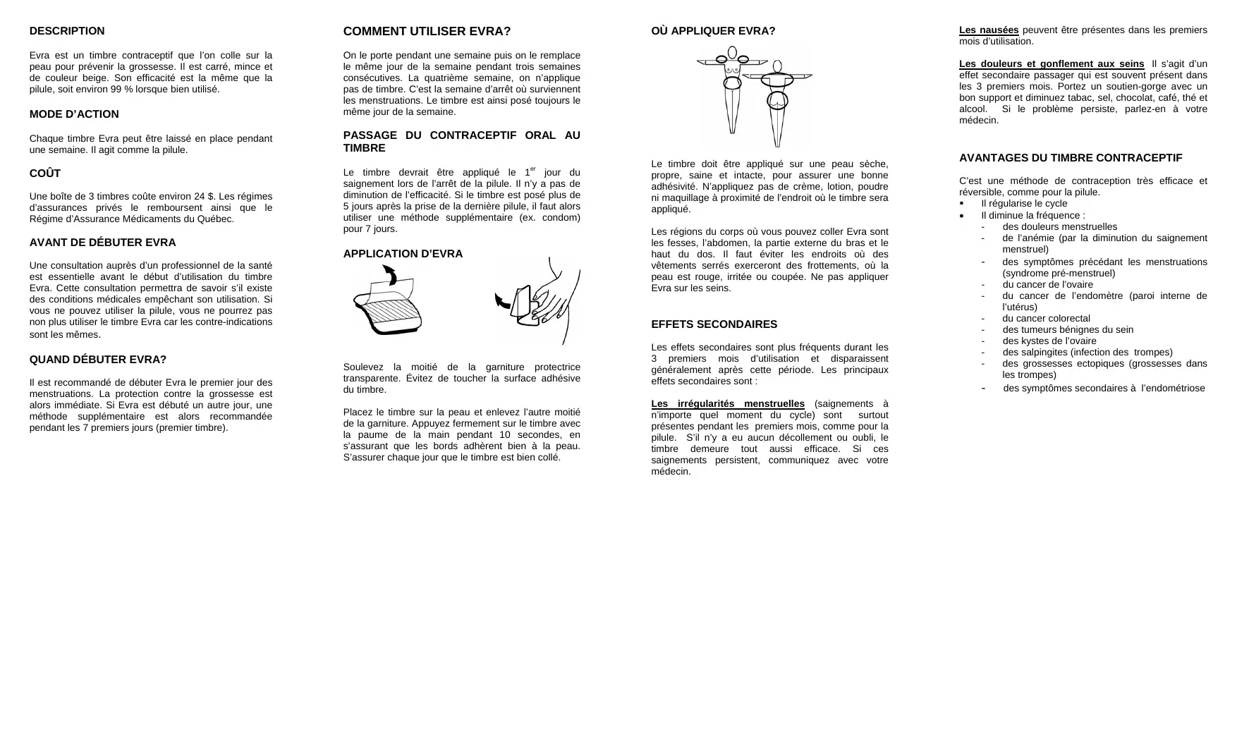 Description du timbre contraceptif Evra, mode d'emploi et zones d'application illustrées sur le corps